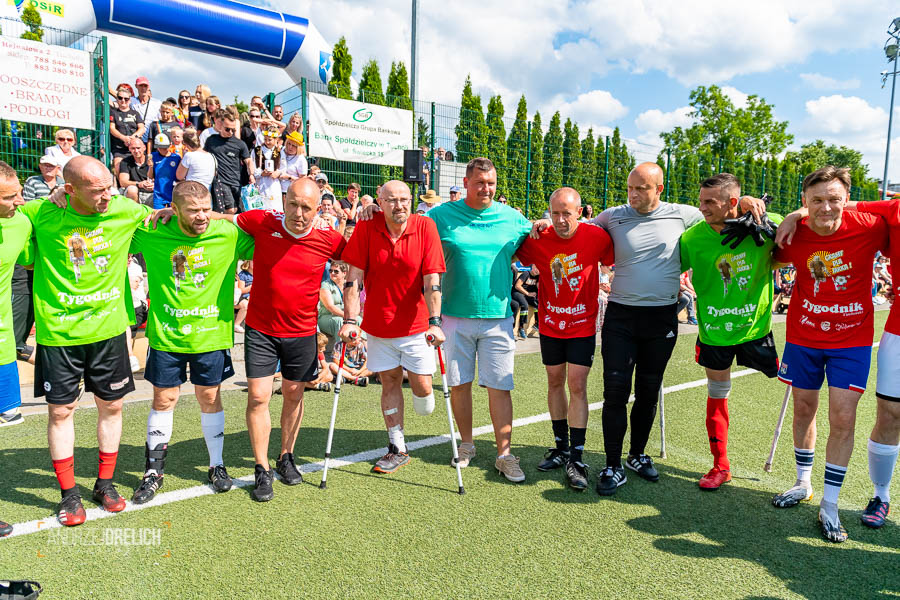 35 tys. zł na protezę dla Jarka (ZDJĘCIA)